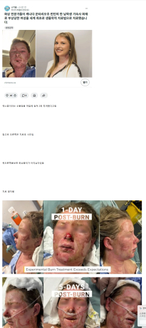 소름돋는 의학기술 발전 근황