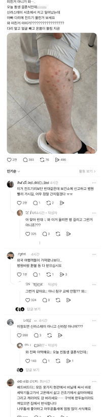 신라스테이에서 자고 일어났는데 아빠 다리 상태가 ㄷㄷ